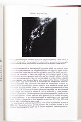Physiology of the Ear (ONLINE ORDER ONLY)