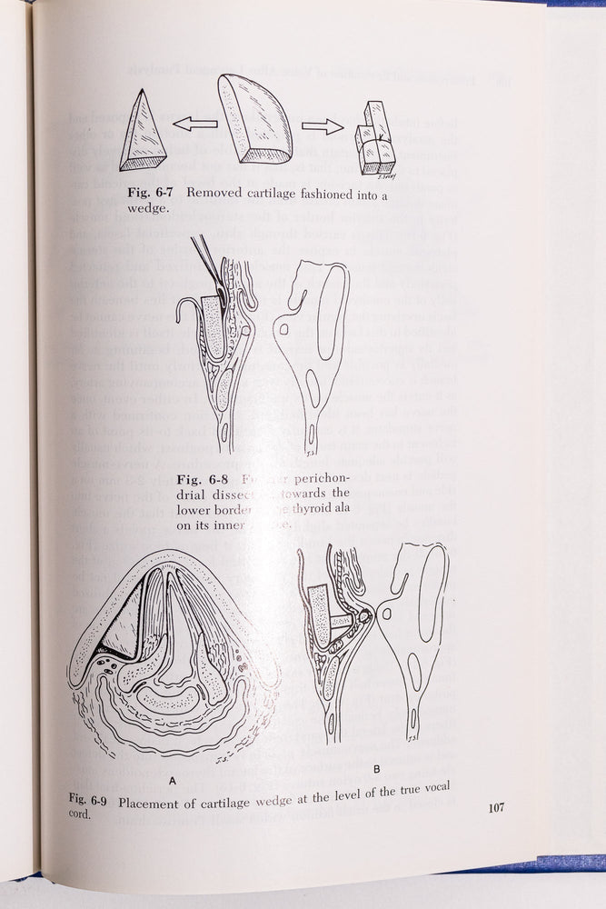 Surgery for Phonatory Disorder (ONLINE ORDER ONLY)
