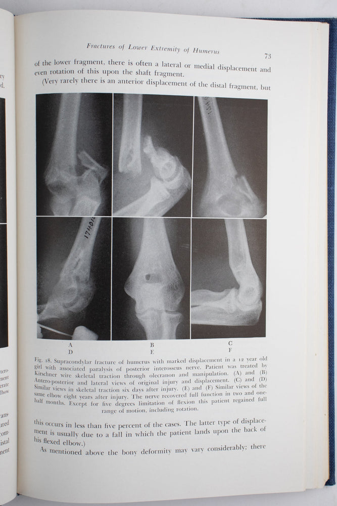 Surgery of the Elbow (ONLINE ORDER ONLY)