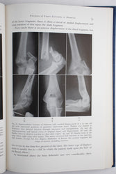 Surgery of the Elbow (ONLINE ORDER ONLY)