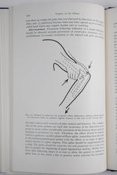 Surgery of the Elbow (ONLINE ORDER ONLY)
