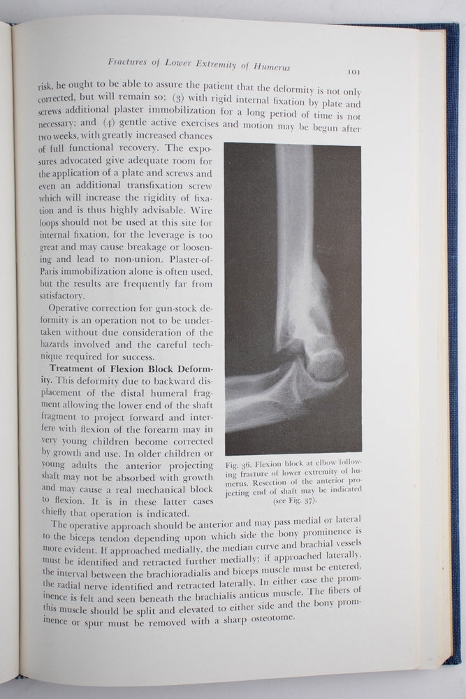 Surgery of the Elbow (ONLINE ORDER ONLY)