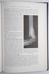 Surgery of the Elbow (ONLINE ORDER ONLY)
