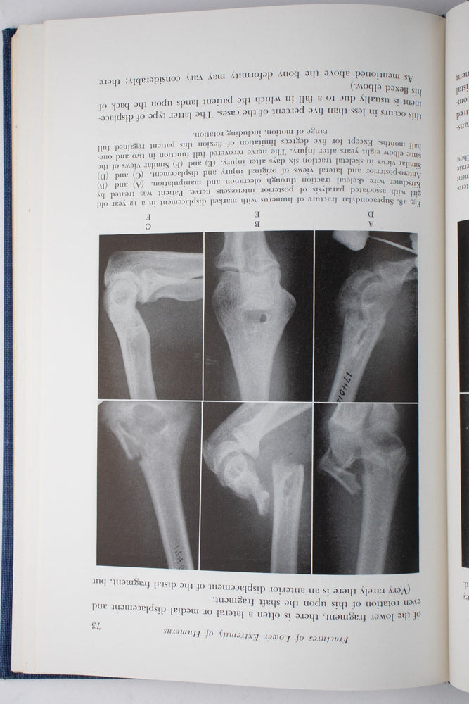 Surgery of the Elbow (ONLINE ORDER ONLY)