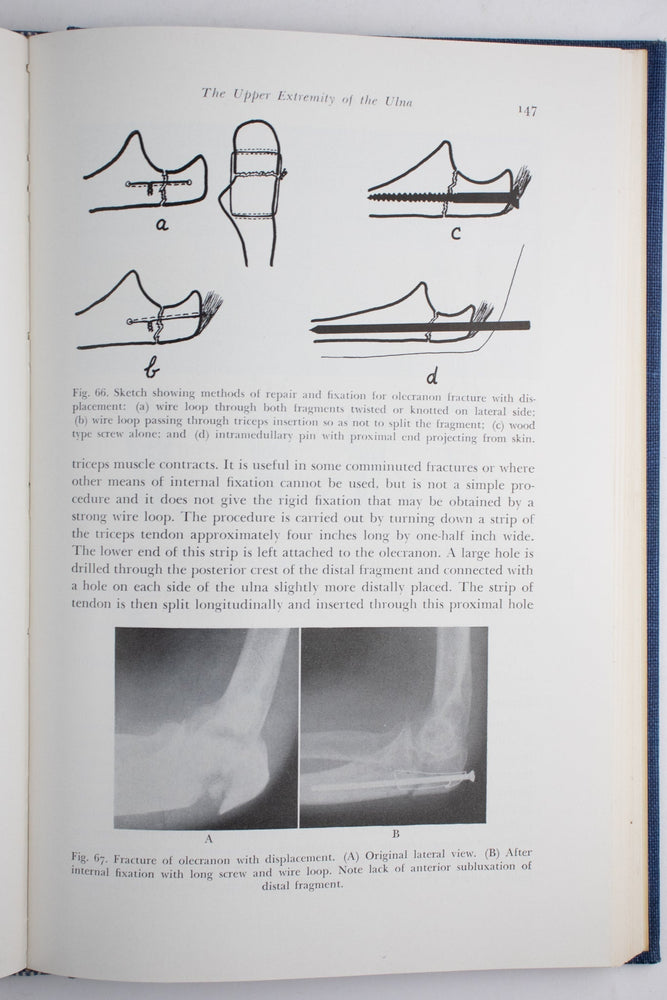 Surgery of the Elbow (ONLINE ORDER ONLY)