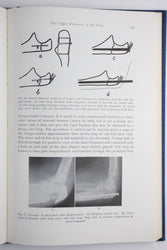 Surgery of the Elbow (ONLINE ORDER ONLY)